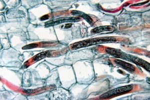 바나나 뿌리 내부의 Radopholus similis, 선충 뿌리썩음병 유발