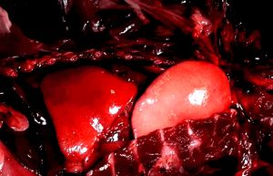 라쿤(Raccoon)의 폐를 수동으로 팽창시키는 모습