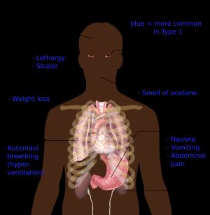 당뇨병의 가장 중요한 증상 개요