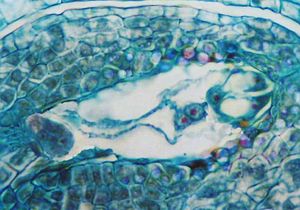 축소된 암 배우체인 배낭