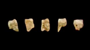 CCH6a–e, 어금니 및 작은 어금니