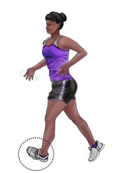 B. 경미한 운동 우세형 파킨슨병