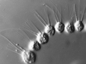 데스마렐라(Desmarella moniliformis) 군체 위상차 현미경 사진