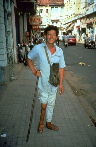 소아마비로 인해 오른쪽 다리가 위축된 남성