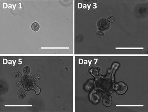 7일 동안 성장하는 장 유사장기(미니 장). 눈금 막대는 200μm이다.