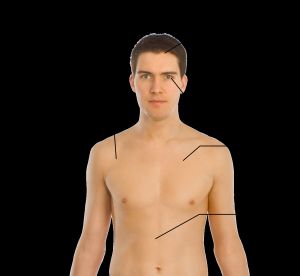 암모니아 과다혈증의 증상