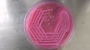 MacConkey 한천배지에서 배양된 락토스 발효균(LF)과 비발효균(NLF)