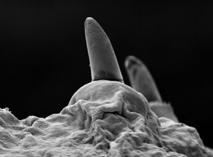 지렁이의 털(강모). 토양 속에서 지렁이의 이동을 돕는 작은 털 모양의 돌기다.