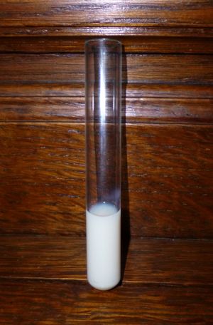 가슴림프관 손상 환자에게서 얻은 사람의 림프