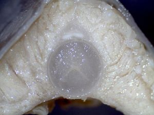 꼼치 몸통 중앙의 수직 단면: 척삭이 유일한 골격 요소이며, 근육에는 수평 중격이나 수직 중격이 없다.