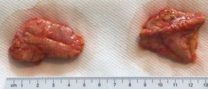 부신, 앞면(왼쪽)과 뒷면(오른쪽)