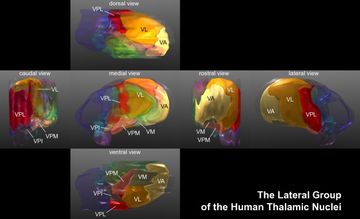 오른쪽 시상의 외측 핵
