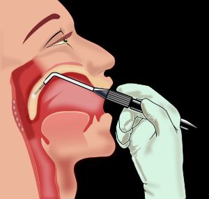 구강 및 인후 수술 그림