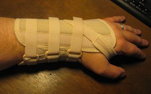 수근관 증후군에 사용되는 다른 유형의 단단한 부목