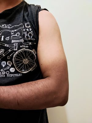 장시간 태양 노출 후 전완의 햇볕에 탐(피부의 눈에 띄는 어두워짐)