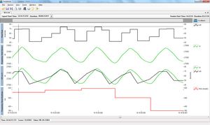 심박수(HR)(위쪽 추세선)와 기도량(Vt)(폐 용량, 아래쪽 추세선)을 동일한 차트에 표시하여 심박수가 흡기 시 증가하고 호기 시 감소하는 방식을 보여줍니다.