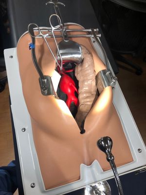 개복 하복부 대동맥 수복 모델. 동맥류 위쪽과 신장 동맥 아래쪽에 수술용 클램프가 보임