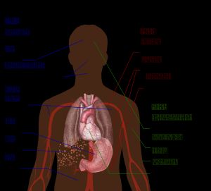 뎅기열의 여러 단계에서 영향을 받는 신체 부위를 보여주는 도식도