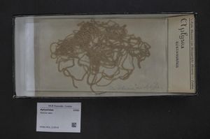 바다토끼류의 알 덩이