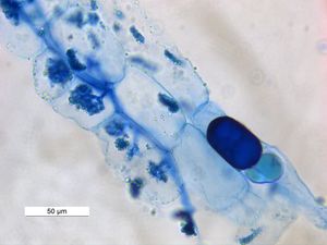 조직 투명화 후 트리판 블루로 염색하여 시각화된 소포체-관다발 균근