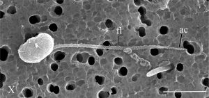 Syssomonas multiformis