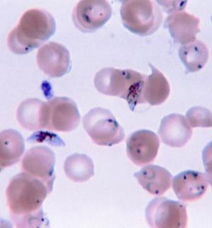 인간 혈액 속의 열대열 말라리아 원충(Plasmodium falciparum)의 현미경 사진(파란색의 뾰족한 모양). 이것은 진핵생물의 기생충으로, 감염병 말라리아의 병원체이다.