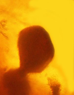 도미니카 호박에 보존된 고대 말라리아 포낭