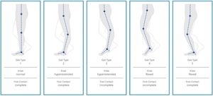 암스테르담 보행 분류(Amsterdam Gait Classification)는 뇌성마비 환자의 보행 패턴 평가를 용이하게 한다. 이는 환자, 의사, 물리치료사, 보조기 전문가 간의 의사소통을 원활하게 한다.