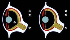 척추동물(왼쪽)과 문어(오른쪽)와 같은 무척추동물의 눈은 독립적으로 발달했다. 척추동물은 맹점이 있는 역전된 망막을 진화시켰지만, 문어는 비역전 망막으로 이를 피했다.(1 광수용체, 2 신경 조직, 3 시신경, 4 맹점)