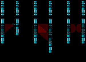 3가지 주요 단일 염색체 이상: 결실(1), 중복(2) 및 역위(3).