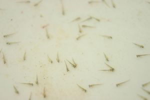 갓 부화한 금붕어 치어(류킨)