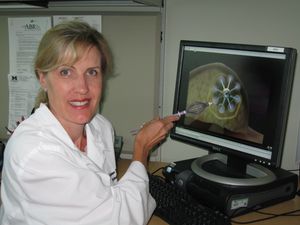 SAVI 근접조사법 장치