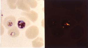 말라리아 색소의 이중굴절: 많은 말라리아 치료제는 헤모조인 결정 성장의 강력한 억제제입니다.
