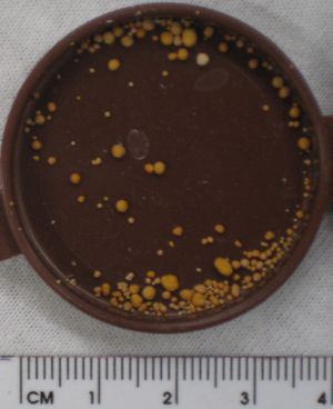 수산칼슘을 포함한 요산 결석