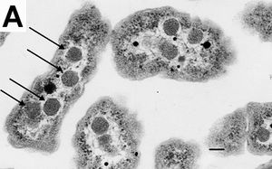 Halothiobacillus neapolitanus 세포 내부의 카르복시솜을 보여주는 전자 현미경 사진이며, 화살표는 보이는 카르복시솜을 강조한다. 눈금 막대는 100nm를 나타낸다.
