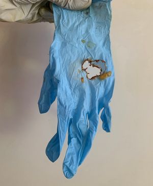 98% 황산 방울에 10분 동안 노출된 니트릴 장갑