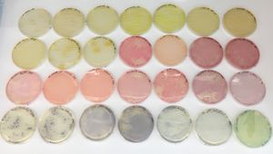 형광 단백질을 발현하는 대장균 집락.