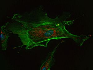 내피 세포의 형광 이미지. 핵은 청색, 미토콘드리아는 적색, 미세섬유는 녹색으로 염색되었다.