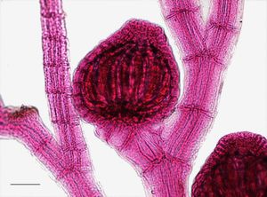 사포자와 사포자체를 보여주는 폴리시포니아의 광학 현미경 사진