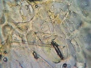 기공을 공격하는 녹병균 균사 (1600배 확대)