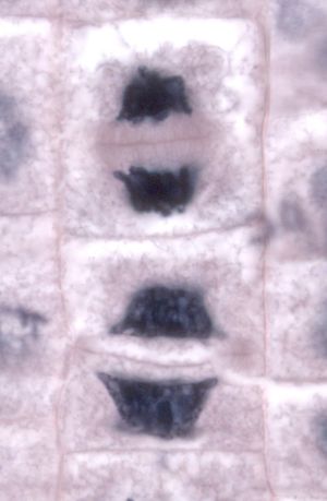 양파 뿌리 세포 현미 사진 - 새로운 세포벽의 원심성 발달을 보여준다.