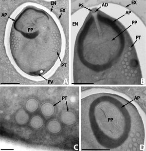 과기생충 미포자충인 Nosema podocotyloidis(노제마 포도코틸로이디스)는 디게네아의 기생충인 Podocotyloides magnatestis(포도코틸로이데스 마그나테스티스)의 기생충이며, 이는 다시 물고기 Parapristipoma octolineatum (경골어류)의 기생충이다.