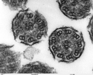 세기관지의 섬모 단면