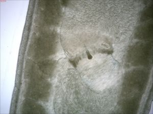 무장된(armed) 끈벌레 Amphiporus ochraceus의 촉수에 있는 작살 부분.