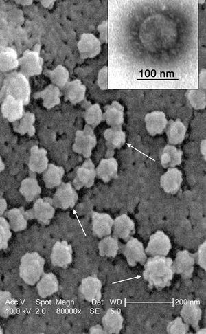 SARS 바이러스 입자의 주사전자현미경 사진