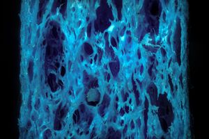 현미경으로 본 셀룰로스