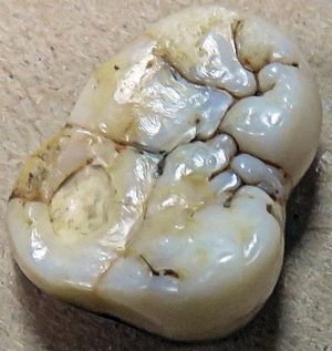 기간토피테쿠스 대구치