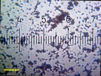 스펀지에서 발견되는 세균