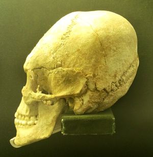 헝가리에서 발견된 훈족 시대 개인의 두개골, 인위적인 두개골 변형을 보여준다.