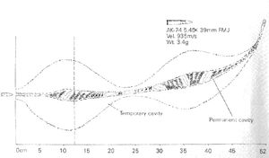 AK-74 5.45×39mm 상처 탄도학